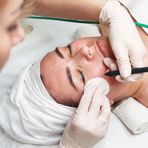 Eletrocauterização de verrugas e pintas